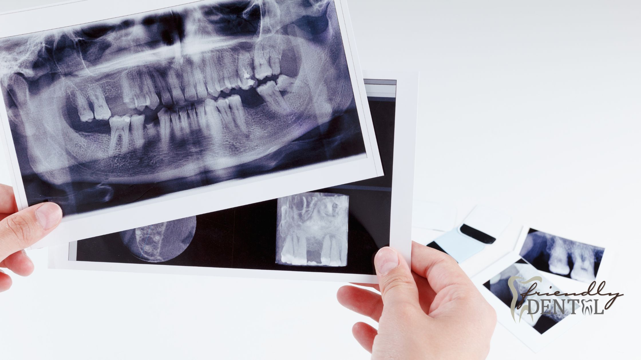 How Safe Are Dental X-Rays?