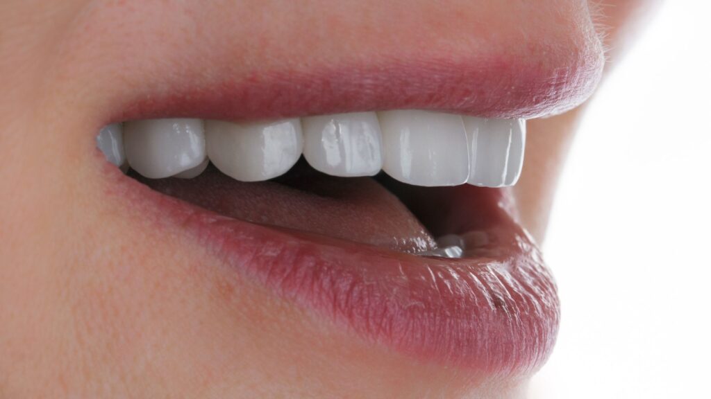Dental Crowns vs Veneers: Which One is Right for You?