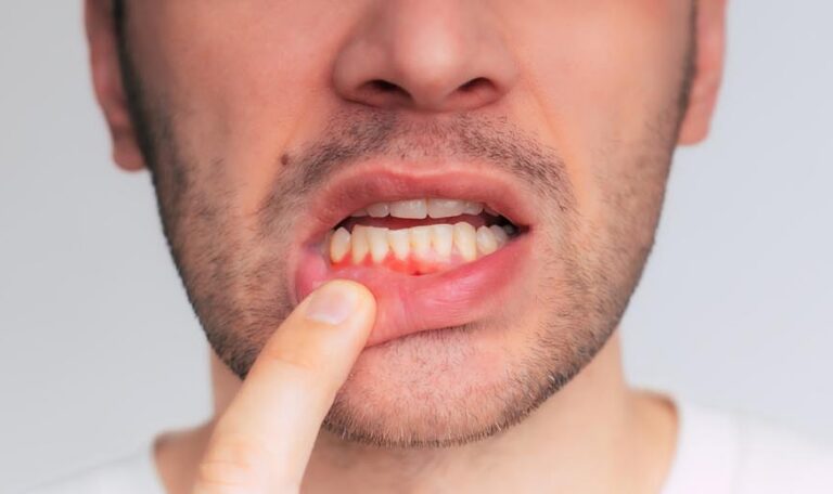 Close up image of gum inflammation. Cropped shot of a young man showing red bleeding gums isolated on a gray background. Dentistry, dental care.
