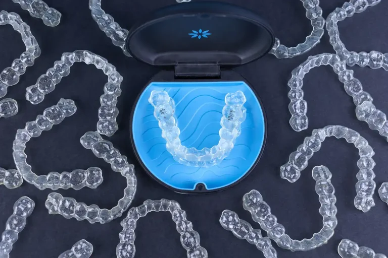 How Does Invisalign® Work? Blog by Friendly Dental in Aberdeen, NJ.